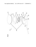 Wound closure product diagram and image