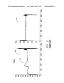 SYSTEMS AND METHODS FOR EMPLOYING MULTIPLE FILTERS TO DETECT T-WAVE OVERSENSING AND TO IMPROVE TACHYARRHYTHMIA DETECTION WITHIN AN IMPLANTABLE MEDICAL DEVICE diagram and image