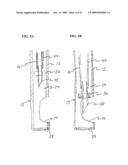 Methods And Systems For Performing Submucosal Medical Procedures diagram and image