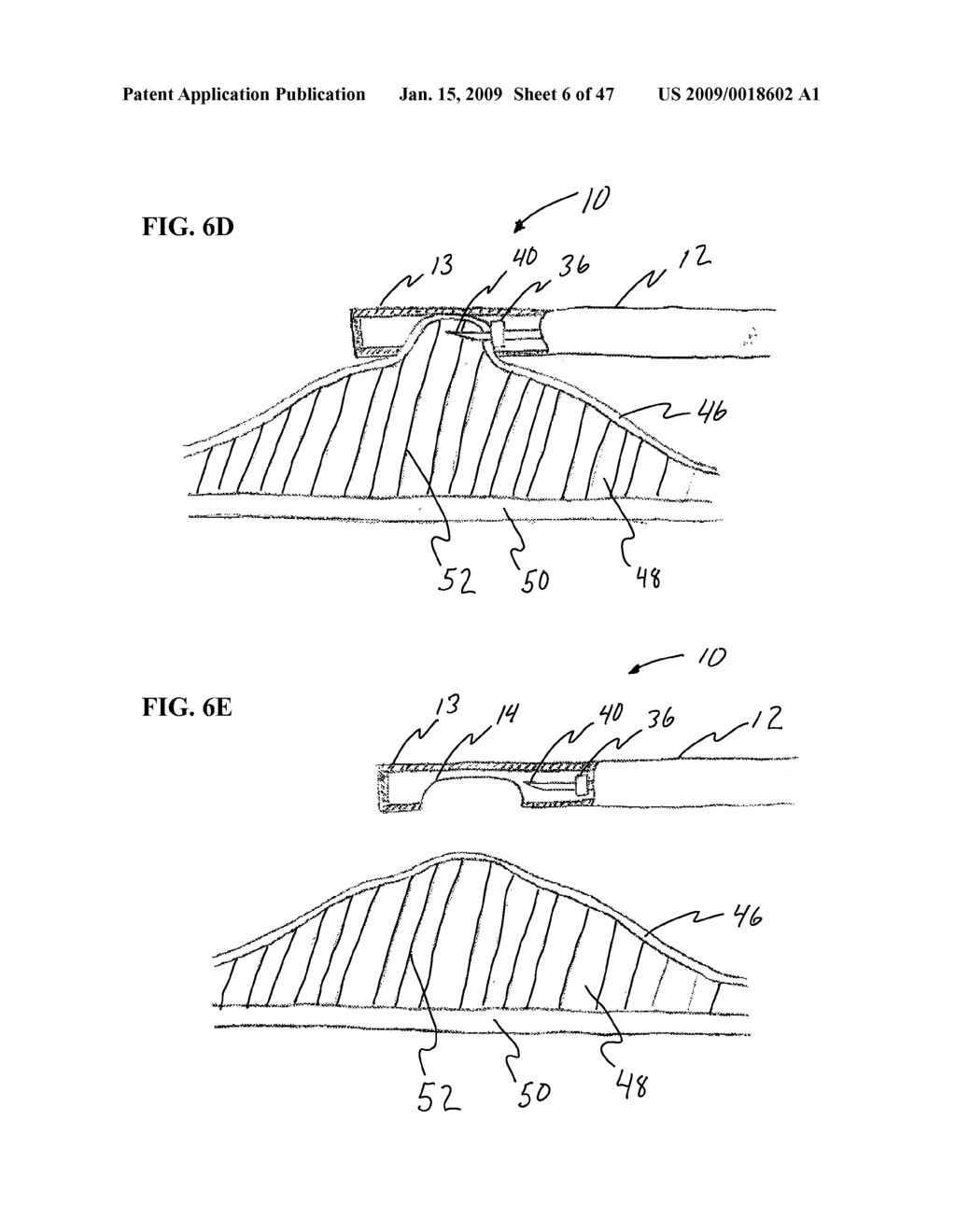 Methods And Systems For Performing Submucosal Medical Procedures - diagram, schematic, and image 07