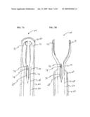 Methods And Systems For Performing Submucosal Medical Procedures diagram and image