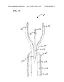 Methods And Systems For Performing Submucosal Medical Procedures diagram and image