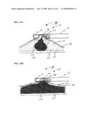 Methods And Systems For Performing Submucosal Medical Procedures diagram and image