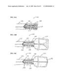 Methods And Systems For Performing Submucosal Medical Procedures diagram and image