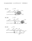 Methods And Systems For Performing Submucosal Medical Procedures diagram and image