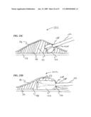 Methods And Systems For Performing Submucosal Medical Procedures diagram and image