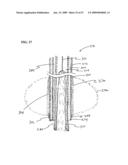 Methods And Systems For Performing Submucosal Medical Procedures diagram and image