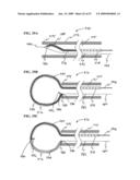 Methods And Systems For Performing Submucosal Medical Procedures diagram and image