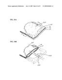 Methods And Systems For Performing Submucosal Medical Procedures diagram and image