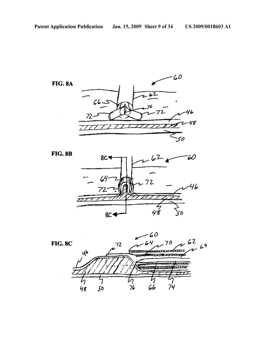 Methods and Systems for Submucosal Implantation of a Device for Diagnosis and Treatment of a Body - diagram, schematic, and image 10