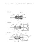 Methods and Systems for Submucosal Implantation of a Device for Diagnosis and Treatment of a Body diagram and image