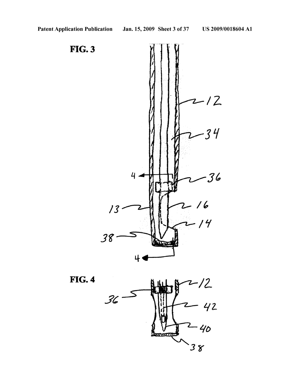 Methods And Systems for Submucosal Implantation of a Device For Diagnosis and Treatment with a Therapeutic Agent - diagram, schematic, and image 04