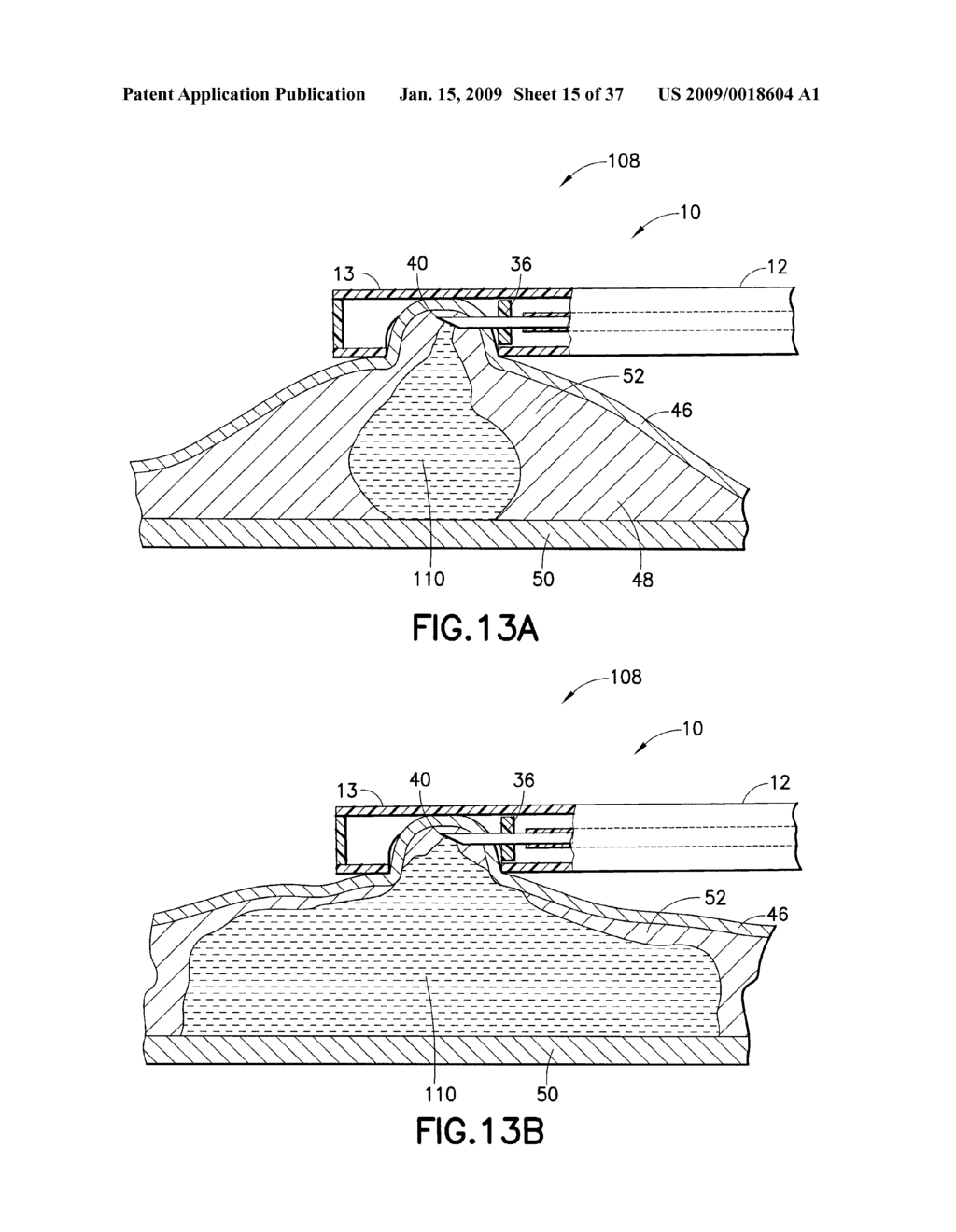 Methods And Systems for Submucosal Implantation of a Device For Diagnosis and Treatment with a Therapeutic Agent - diagram, schematic, and image 16