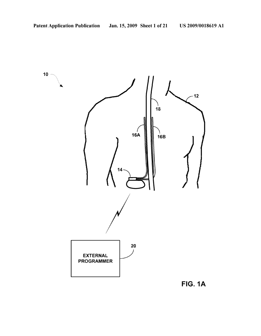 SHIFTING OF ELECTRICAL STIMULATION ELECTRODE COMBINATIONS AMONG DIFFERENTLY SIZED ELECTRODE ARRAYS - diagram, schematic, and image 02