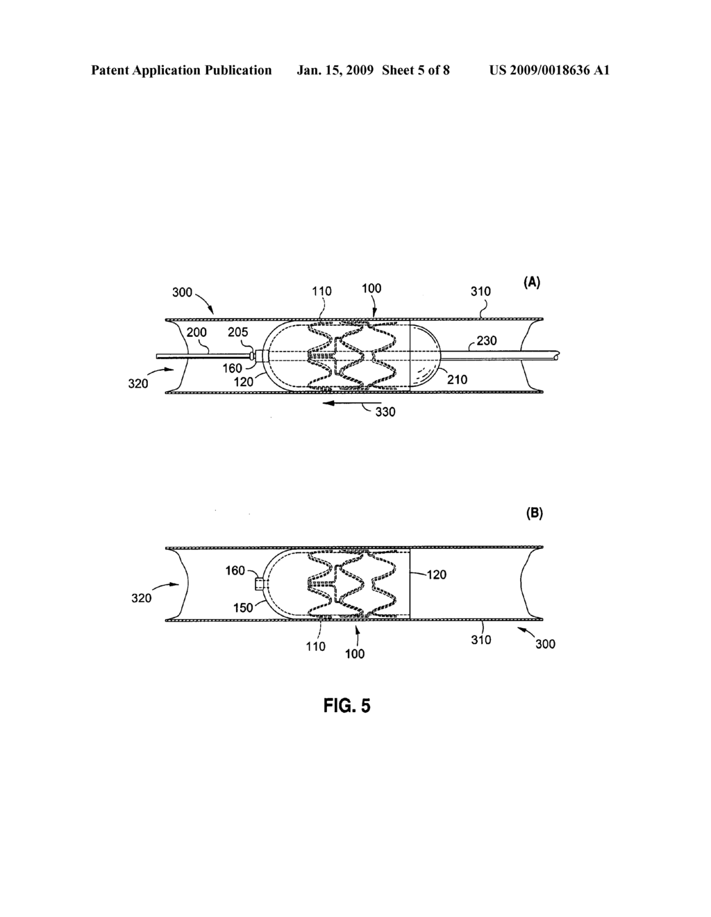 Methods and apparatus for rapid endovascular vessel occlusion and blood flow interruption - diagram, schematic, and image 06