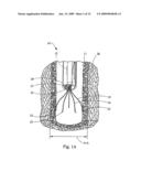 Minimally invasive medical device and method for delivery of therapeutic or diagnostic agents into a vessel wall diagram and image