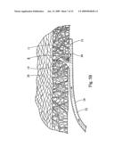 Minimally invasive medical device and method for delivery of therapeutic or diagnostic agents into a vessel wall diagram and image