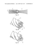 Minimally invasive medical device and method for delivery of therapeutic or diagnostic agents into a vessel wall diagram and image