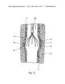 Minimally invasive medical device and method for delivery of therapeutic or diagnostic agents into a vessel wall diagram and image