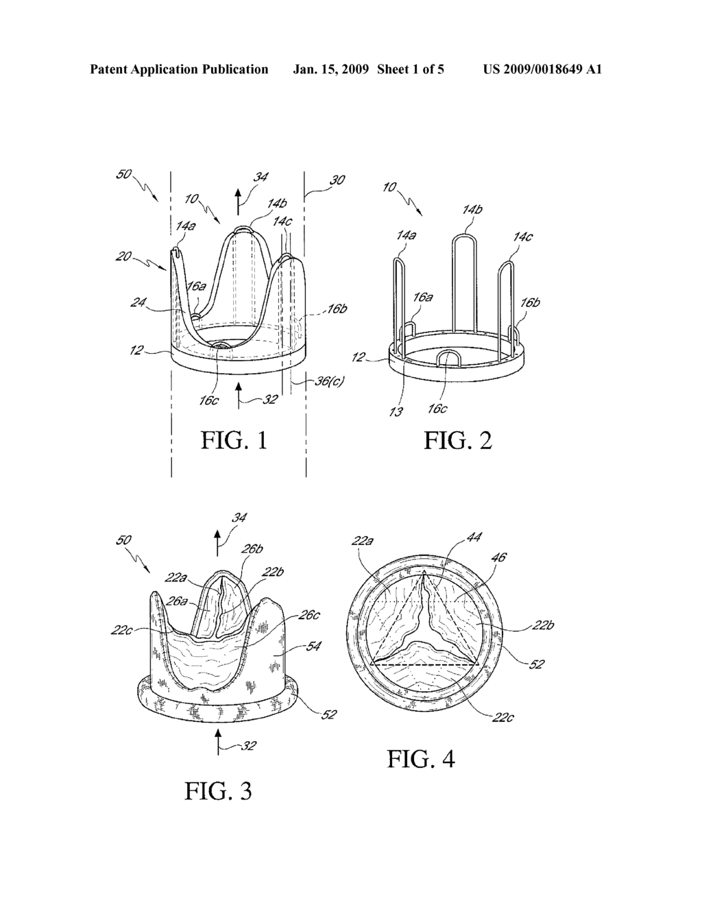 REINFORCEMENT DEVICE FOR A BIOLOGICAL VALVE AND REINFORCED BIOLOGICAL VALVE - diagram, schematic, and image 02