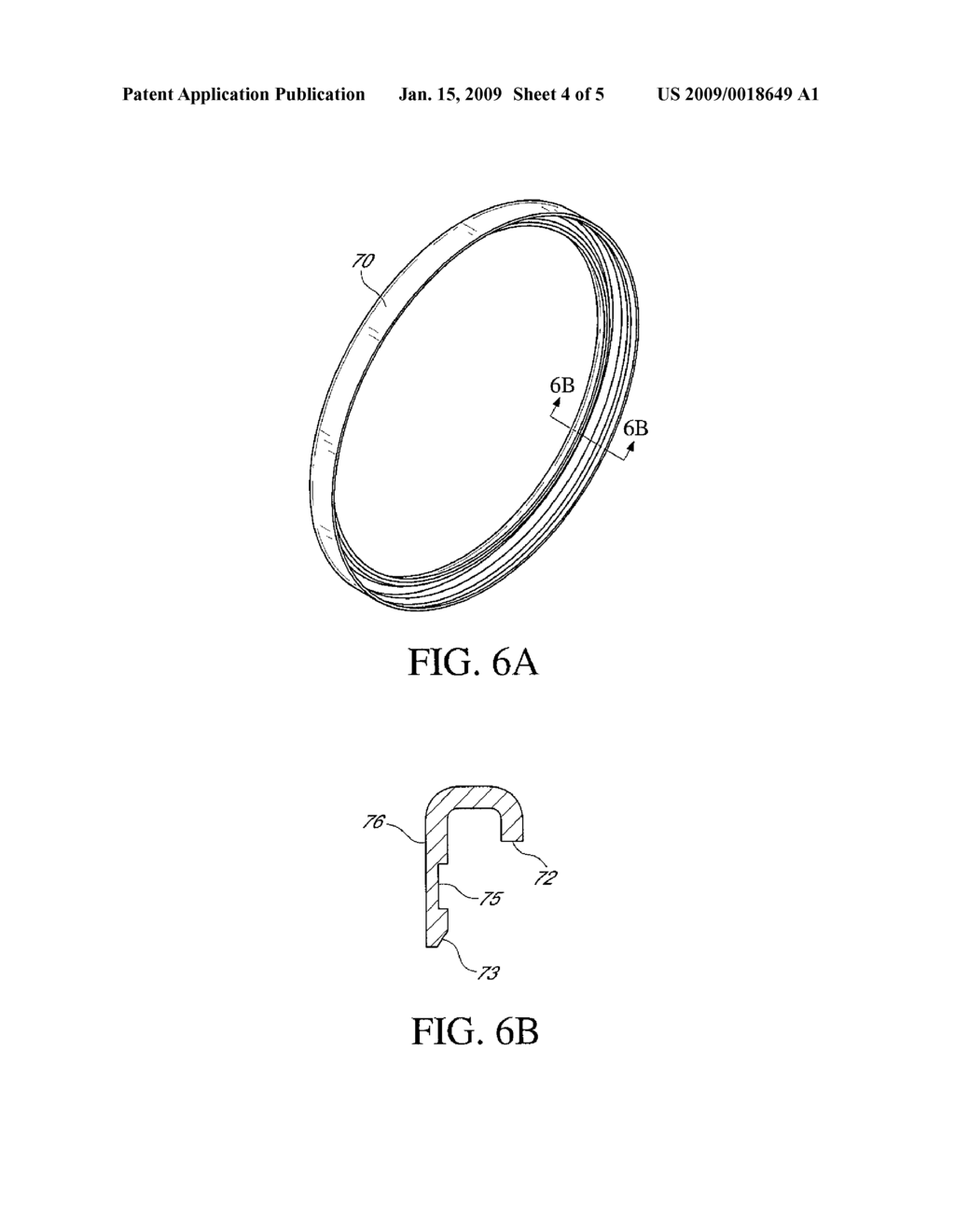 REINFORCEMENT DEVICE FOR A BIOLOGICAL VALVE AND REINFORCED BIOLOGICAL VALVE - diagram, schematic, and image 05