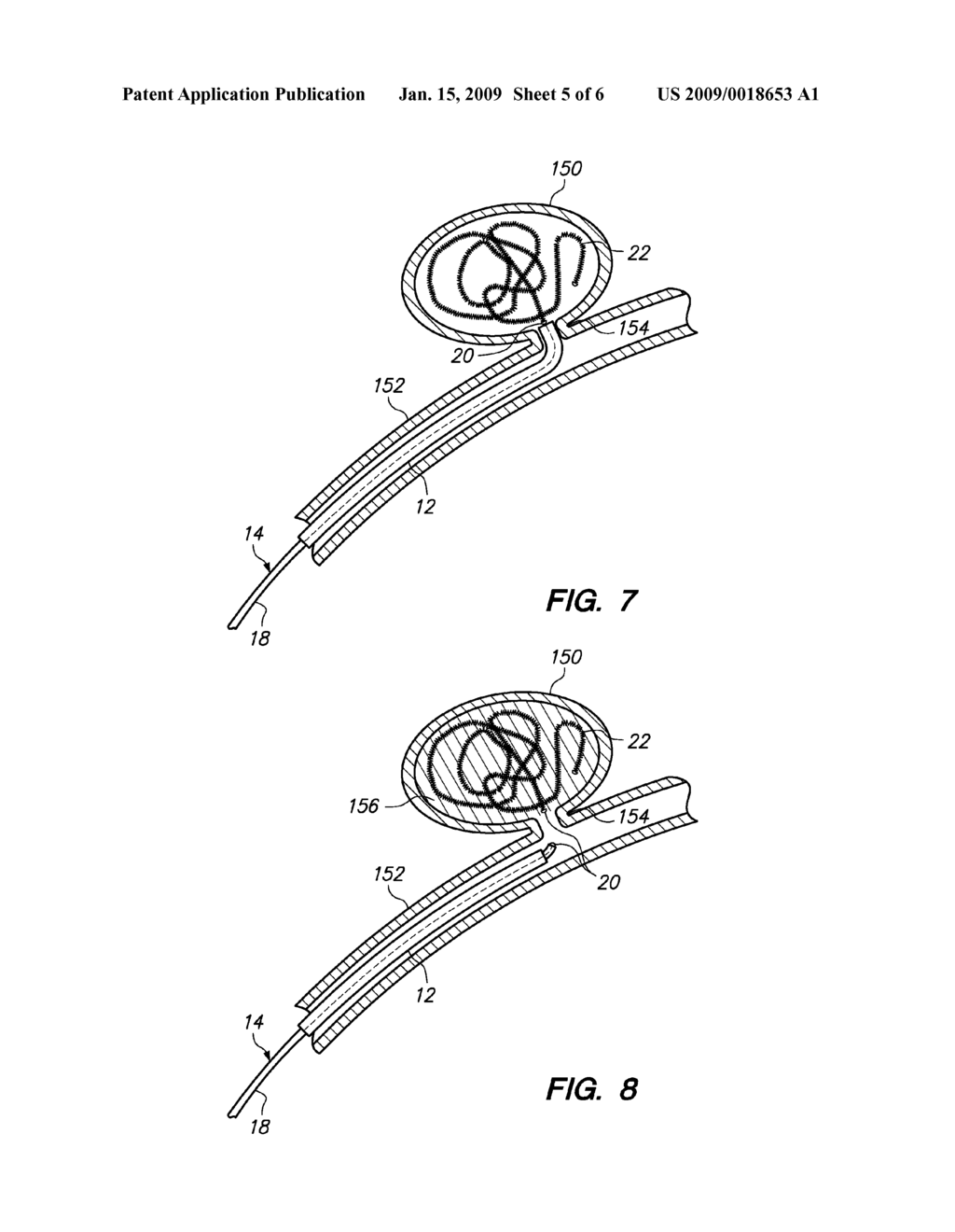 HYBRID AND PORTABLE POWER SUPPLIES FOR ELECTROLYTICALLY DETACHING IMPLANTABLE MEDICAL DEVICES - diagram, schematic, and image 06