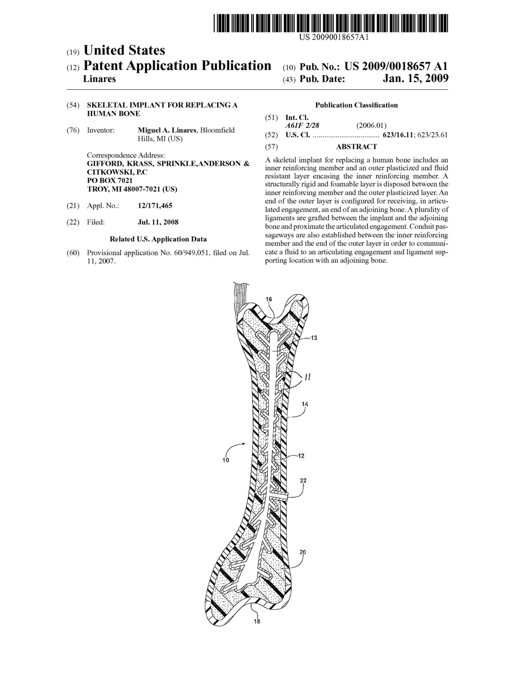 SKELETAL IMPLANT FOR REPLACING A HUMAN BONE - diagram, schematic, and image 01