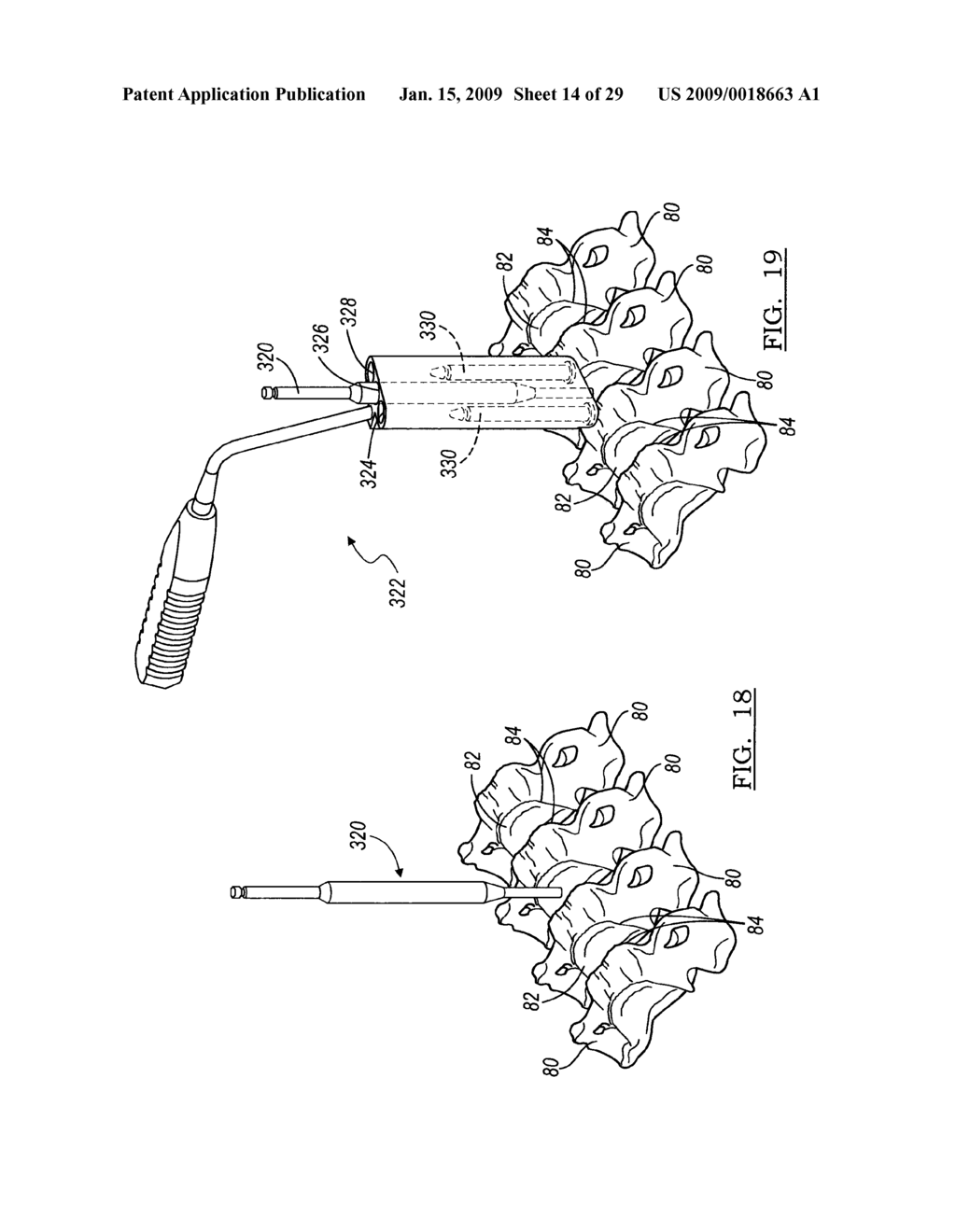 INTERVERTEBRAL IMPLANT AND ASSOCIATED METHOD - diagram, schematic, and image 15