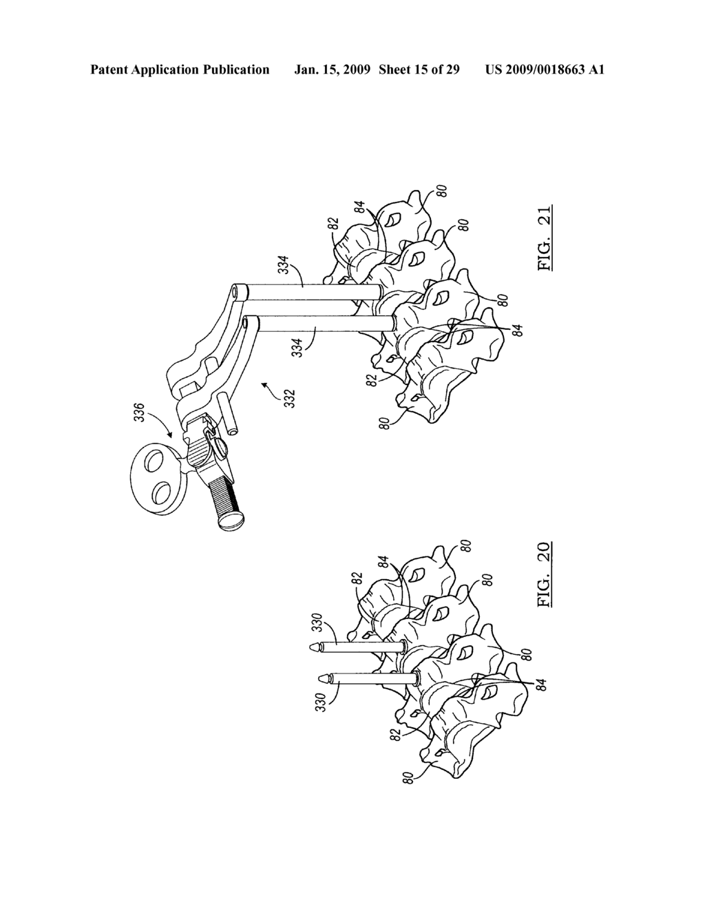 INTERVERTEBRAL IMPLANT AND ASSOCIATED METHOD - diagram, schematic, and image 16