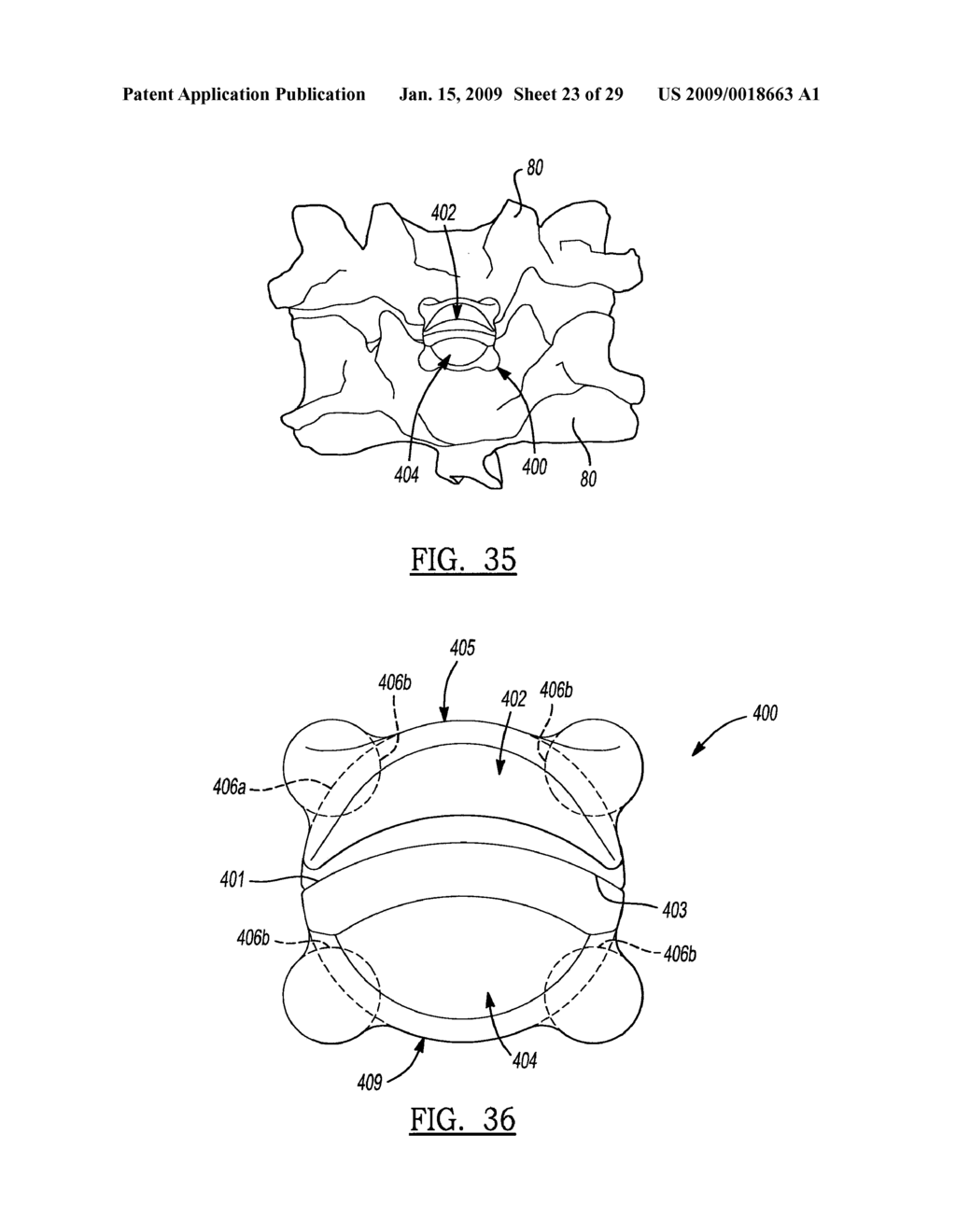 INTERVERTEBRAL IMPLANT AND ASSOCIATED METHOD - diagram, schematic, and image 24