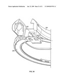 Egg slicer diagram and image