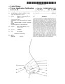 Nasal dilator with cushion layer and variable spring rate diagram and image