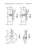 Flapper Mounted Equalizer Valve for Subsurface Safety Valves diagram and image