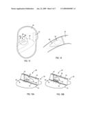 Multi-chambered side airbag diagram and image