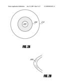 SYSTEM AND METHOD FOR INCREASING THE DEPTH OF FOCUS OF THE HUMAN EYE diagram and image