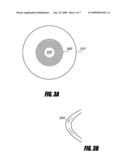 SYSTEM AND METHOD FOR INCREASING THE DEPTH OF FOCUS OF THE HUMAN EYE diagram and image