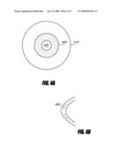 SYSTEM AND METHOD FOR INCREASING THE DEPTH OF FOCUS OF THE HUMAN EYE diagram and image