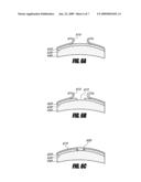 SYSTEM AND METHOD FOR INCREASING THE DEPTH OF FOCUS OF THE HUMAN EYE diagram and image