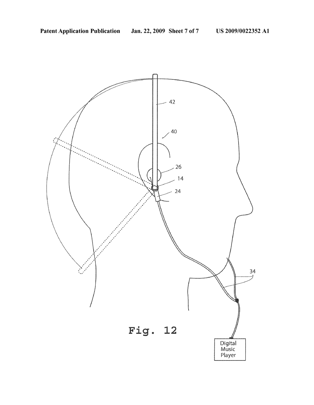 EARBUD KEEPER - diagram, schematic, and image 08