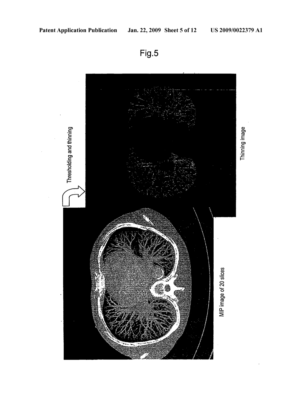 Method for Quantifying Organ Motion, Apparatus Therefor, Method for Estimating Organ Position, Apparatus Therefor, Method for Irradiating Radiation, Apparatus Therefor, and Apparatus for Detecting Abnormal Organ - diagram, schematic, and image 06