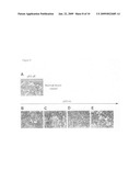 Orthotopic, controllable, and genetically tractable non-human animal model for cancer diagram and image