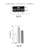 Trefoil Factors and Methods of Treating Proliferation Disorders Using Same diagram and image