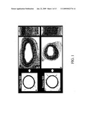 COMPOSITION AND METHOD FOR TREATMENT AND PREVENTION OF RESTENOSIS diagram and image