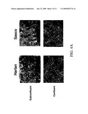 COMPOSITION AND METHOD FOR TREATMENT AND PREVENTION OF RESTENOSIS diagram and image