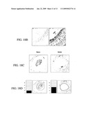 COMPOSITION AND METHOD FOR TREATMENT AND PREVENTION OF RESTENOSIS diagram and image