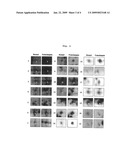 Method of screening placental proteins responsible for pathophysiology of preeclampsia, and marker for early diagnosis and prediction of preeclampsia diagram and image