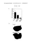 Neovascularization Inhibitors Derived From HGF and Methods Involving the Same diagram and image