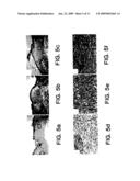 Thymosin beta 4 compositions and methods diagram and image