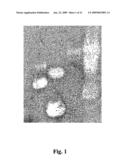 USE OF ANTIMICROBIAL PROTEINS AND PEPTIDES FOR THE TREATMENT OF OTITIS MEDIA AND PARANASAL SINUSITIS diagram and image