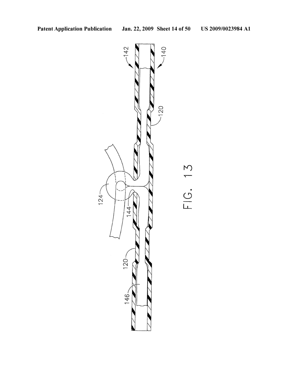 DEVICE FOR INSUFFLATING THE INTERIOR OF A GASTRIC CAVITY OF A PATIENT - diagram, schematic, and image 15